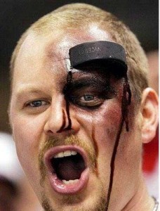 Balle de hockey dans la face d'un joueur de cosom à Montréal